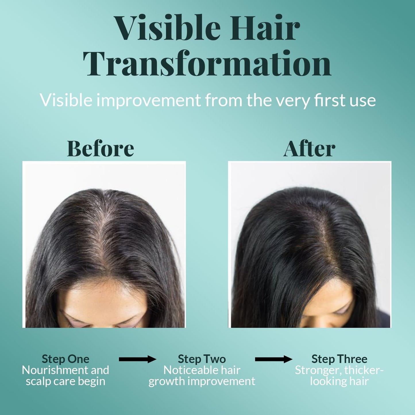 AVD Organics Rosemary Oil for Hair Growth | Infused with Biotin | Hair Strengthening, Nourishing and Volumizing | infused with Jojoba & Castor Oil | NON - GMO 120ml