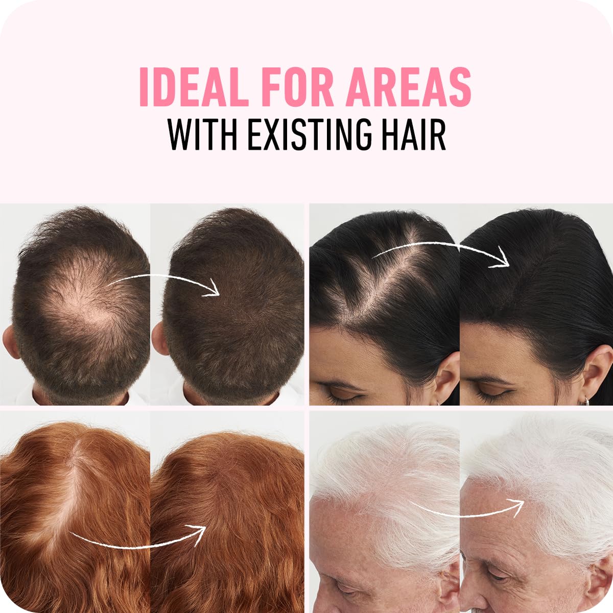 BOLDIFY Hair Fibers (28g) - Fill In Thinning and Fine Hair for an Instantly Fuller, Thicker Look - 14 Shades for Women & Men - Black - Available at All In One Marketplace Canada
