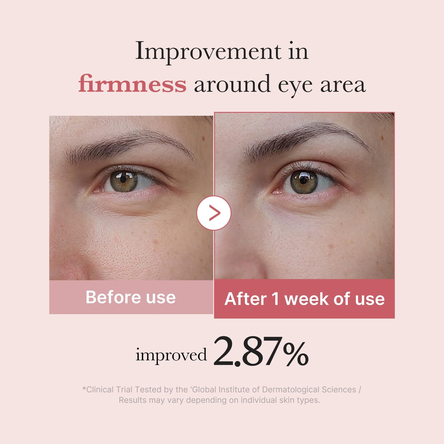 medicube Salmon DNA PDRN Pink Peptide Eye Serum with Niacinamide and 99% Purity Retinol for Fine Lines, Uneven Skin Tone, Korean Skin Care 1.01fl.oz - Available at All In One Marketplace Canada