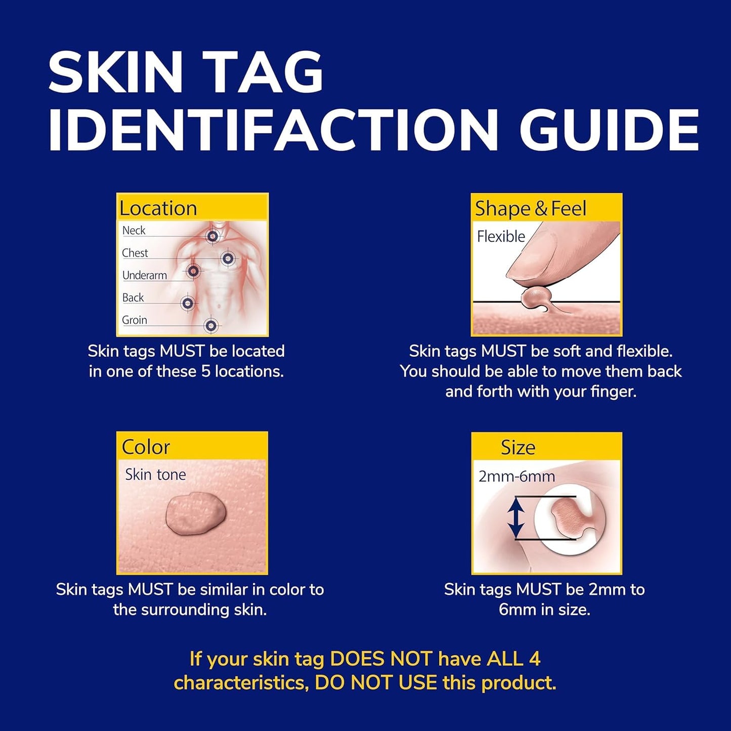 Dr. Scholl's Freeze Away Skin Tag Remover - At Home Skin tag Removal kit. Clinically Proven Skin Tag Removal in as Little as 1 Treatment. 1 Skin tag Removal kit, 12 Treatments - Available at All In One Marketplace Canada