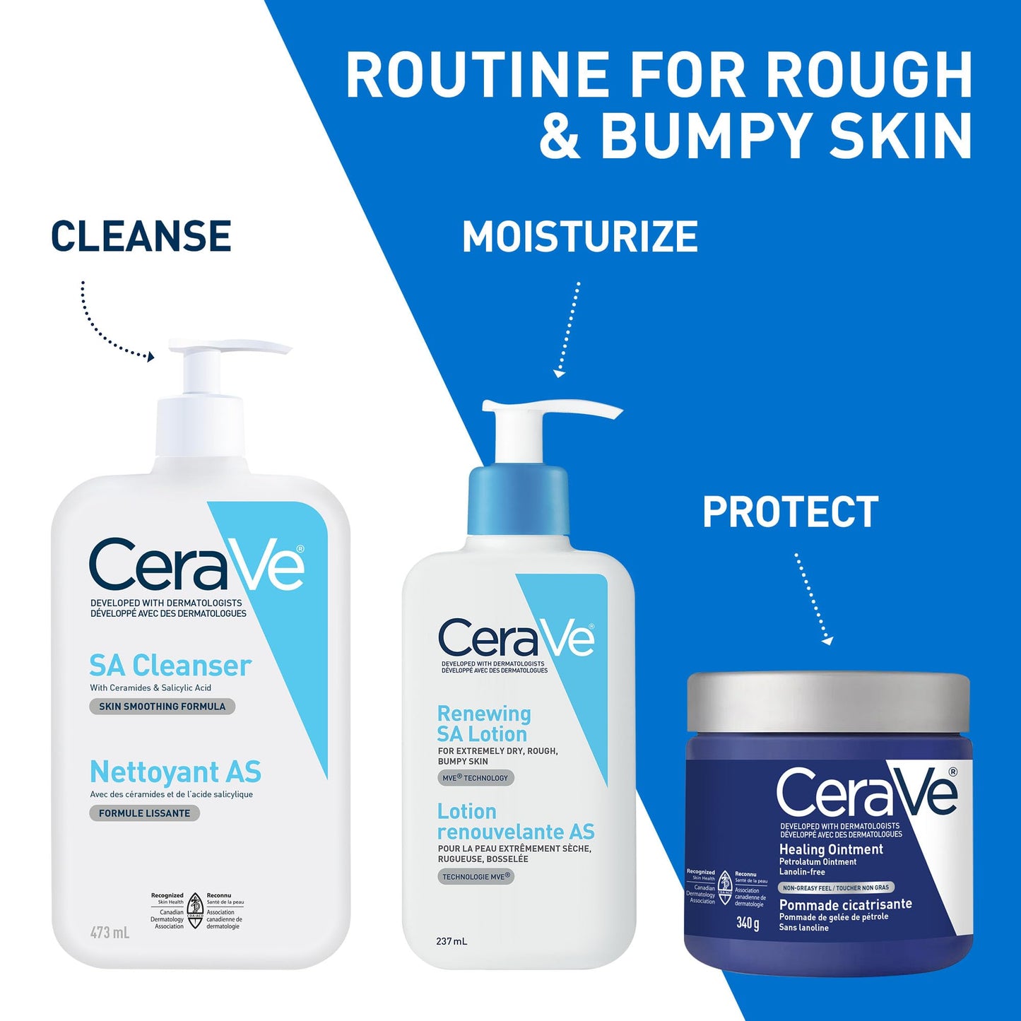 CeraVe SALICYLIC ACID Lotion, Renewing SA Exfoliating Body Lotion for Dry, Rough & Bumpy Skin, Psoriasis, Keratosis Pilaris, Itching & Flaking. With Lactic Acid, Hyaluronic Acid, Fragrance Free, 237ML