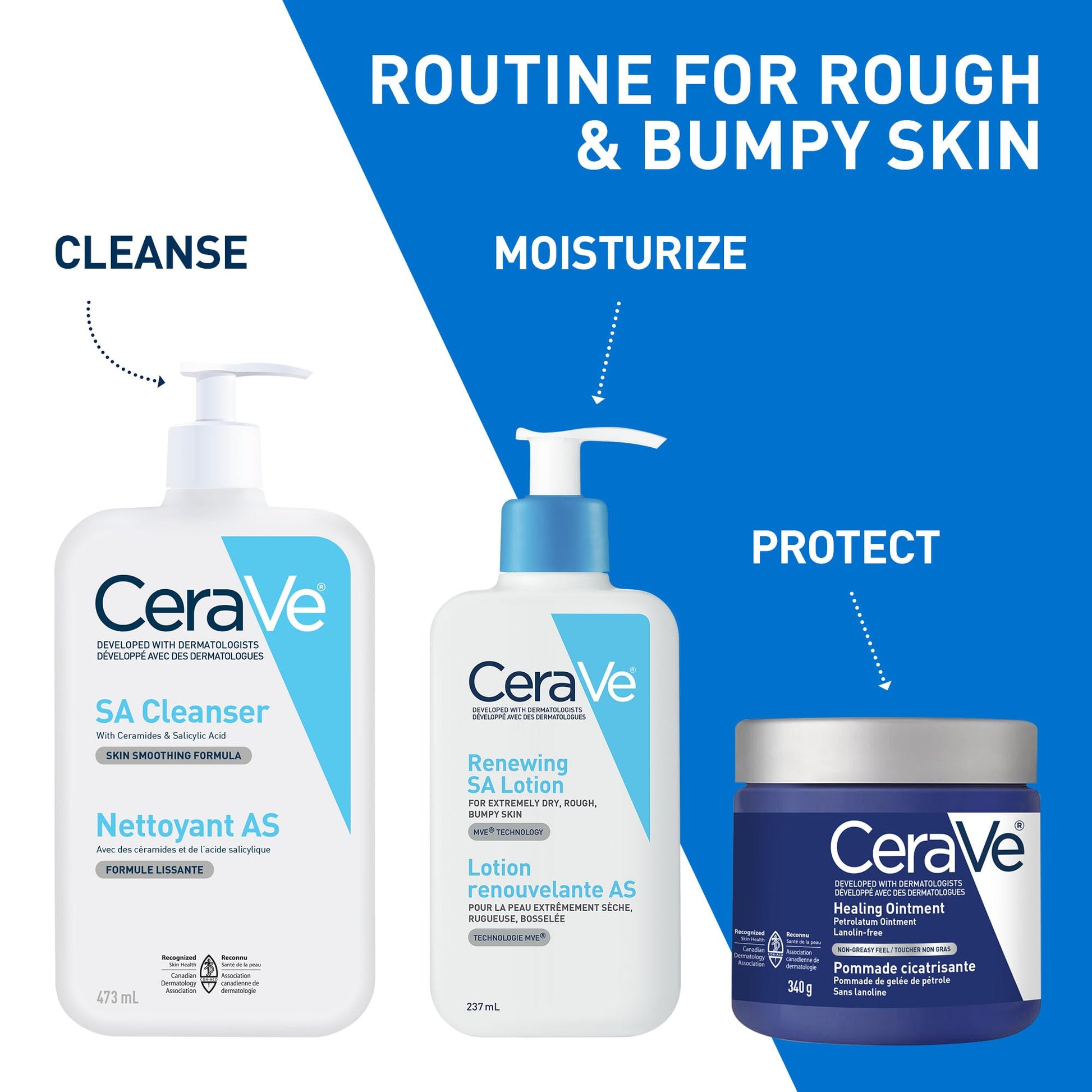CeraVe SALICYLIC ACID Lotion, Renewing SA Exfoliating Body Lotion for Dry, Rough & Bumpy Skin, Psoriasis, Keratosis Pilaris, Itching & Flaking. With Lactic Acid, Hyaluronic Acid, Fragrance Free, 237ML