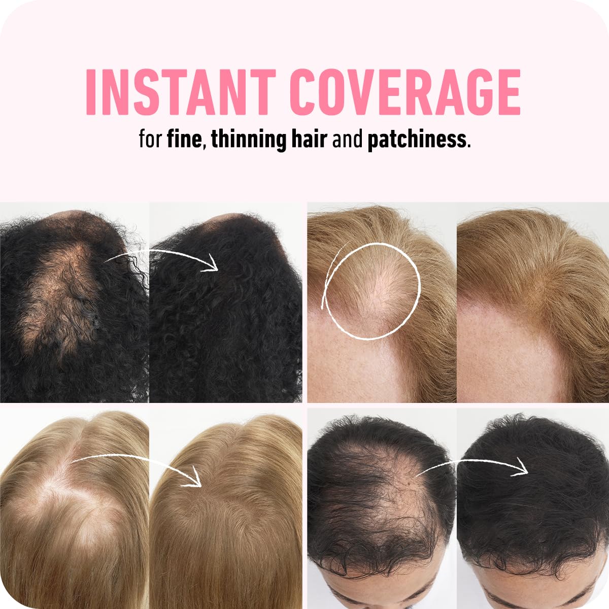 BOLDIFY Hair Fibers (28g) - Fill In Thinning and Fine Hair for an Instantly Fuller, Thicker Look - 14 Shades for Women & Men - Black - Available at All In One Marketplace Canada