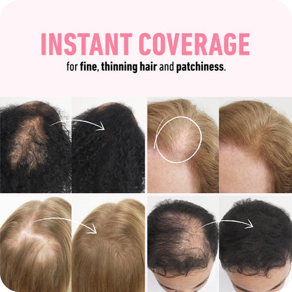 BOLDIFY Hair Fibers (28g) - Fill In Thinning and Fine Hair for an Instantly Fuller, Thicker Look - 14 Shades for Women & Men - Black - Available at All In One Marketplace Canada
