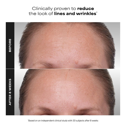 Paula's Choice CLINICAL 1% Retinol Treatment Cream with Peptides, Vitamin C & Licorice Extract, Anti-Aging Treatment for Wrinkles & Loss of Firmness, Fragrance-Free, 30 mL - Available at All In One Marketplace Canada