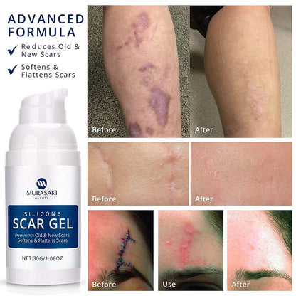 100% Silicone Scar Gel Scar Cream - Advanced Scar Gel for Old and New Scars - Available at All In One Marketplace Canada