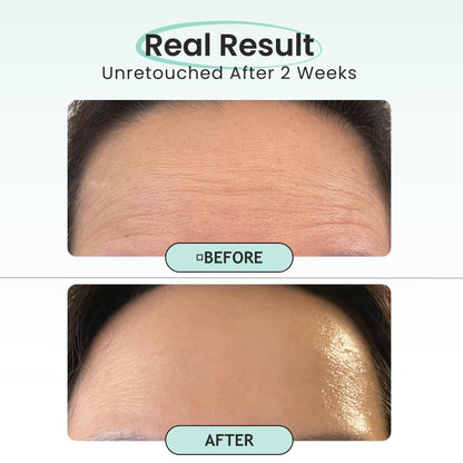 Petite Pluie Overnight Use Advanced Canadian Forehead Smoothing Patches - Premium Hydrogel Non-Sticky Hydration Collagen Face Mask - Superior Adhesion with Extra Large Size for Necklines & Frown Lines Treatment, Made in Korea, 10 Count - Available at All In One Marketplace Canada