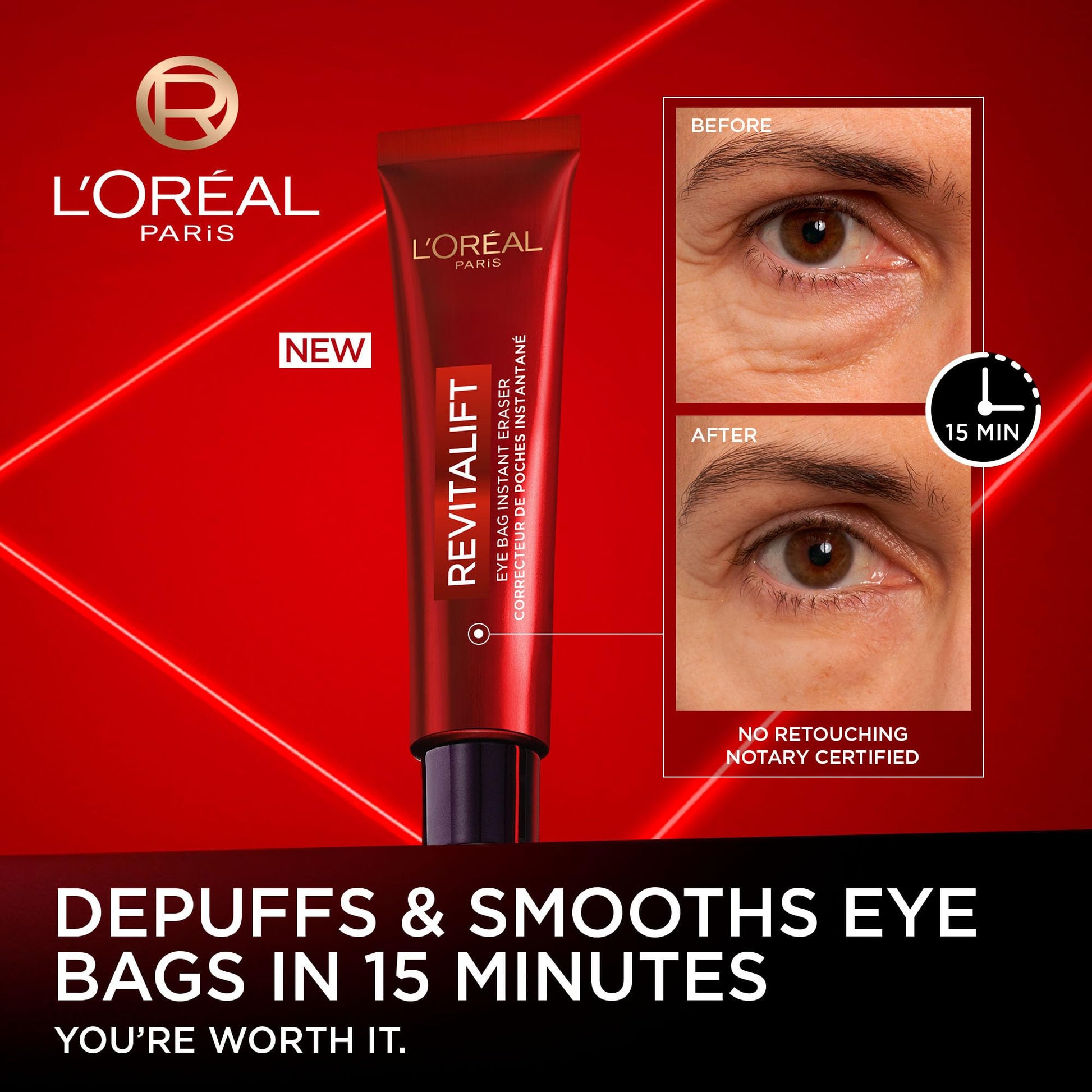 L'Oréal Paris Revitalift Triple Power LZR Instant Eraser Eye Cream, Under Eye Cream for Puffiness and Wrinkles, Anti Aging, Needle-Free Procedure Alternative, 15 mL