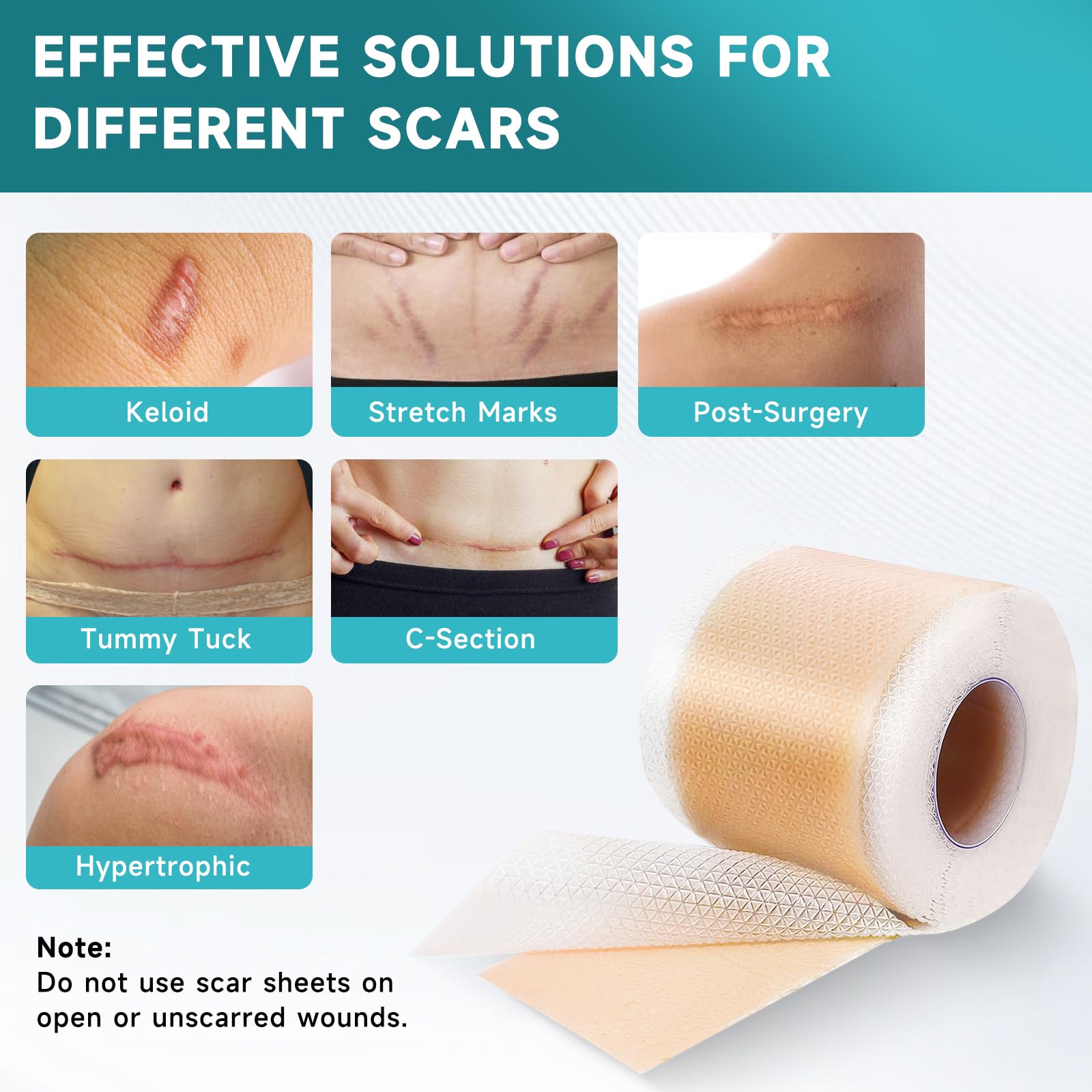 Pumkot Silicone Scar Sheets, Silicone Scar Tape(1.6” x 120” Roll-3M) - Available at All In One Marketplace Canada