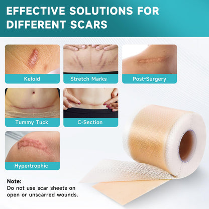 Pumkot Silicone Scar Sheets, Silicone Scar Tape(1.6” x 120” Roll-3M) - Available at All In One Marketplace Canada