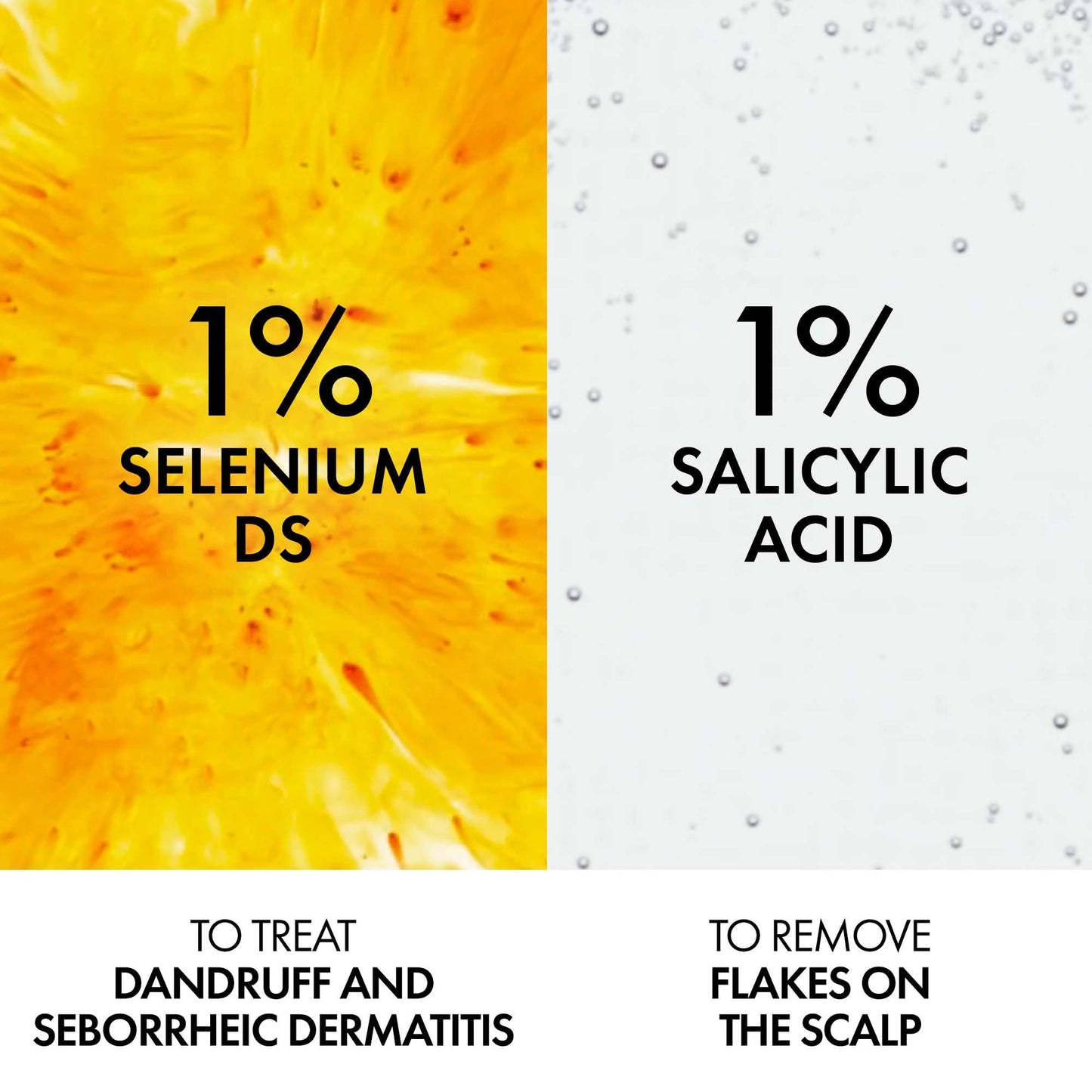 Vichy Dercos Dandruff Shampoo for Dry-Normal Hair, Anti Dandruff Soothing Scalp Care with Selenium DS & Salicylic Acid, Reduces Visible Dandruff Flakes & Improves Scalp Health, 200mL - Available at All In One Marketplace Canada