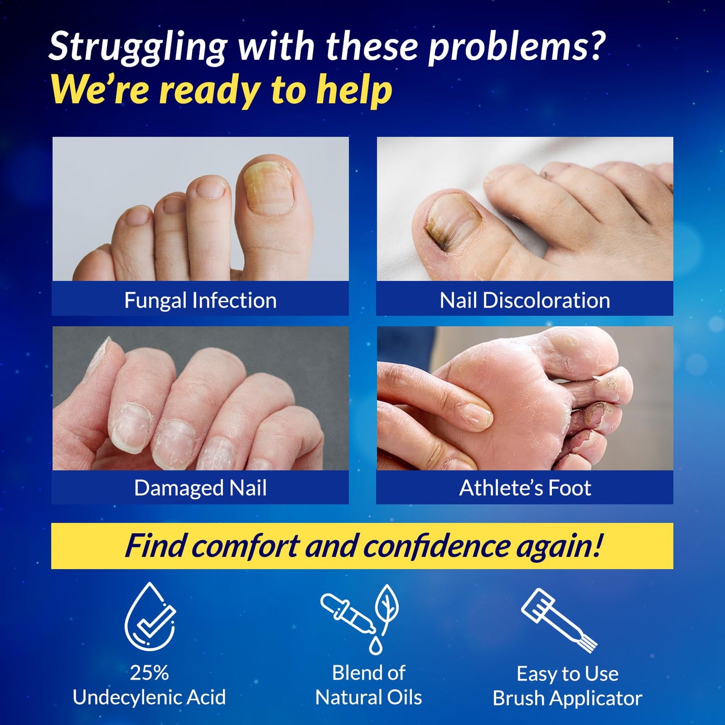 Arflom Toenail Fungus Treatment : 25% Undecylenic Fungal Nail Treatment Extra Strength - Toe and Fingernail with Tea Tree Oil (2pcs, 15ml each) - Available at All In One Marketplace Canada