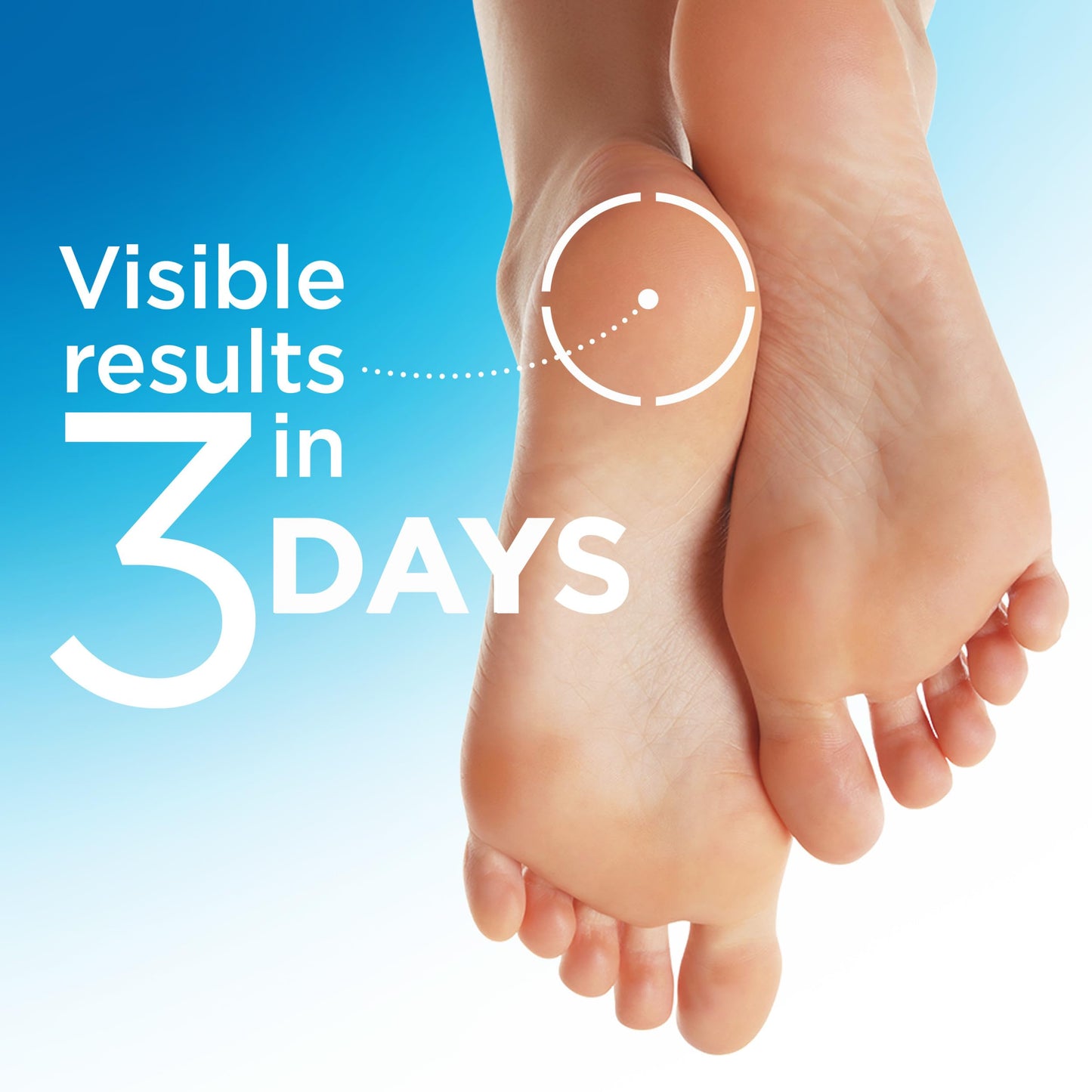 Flexitol Heel Magic for Treating Cracked and Dry Heels (70g) - Available at All In One Marketplace Canada