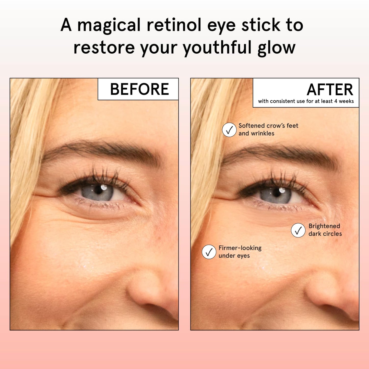 grace & stella Retinol & Caffeine Eye Cream Stick - Under Eye Cream for Dark Circles, Anti-Aging, Puffiness, Wrinkles, Undereye Bags - Brightener with Niacinamide - Vegan Skincare (0.13 oz/3.5 g)