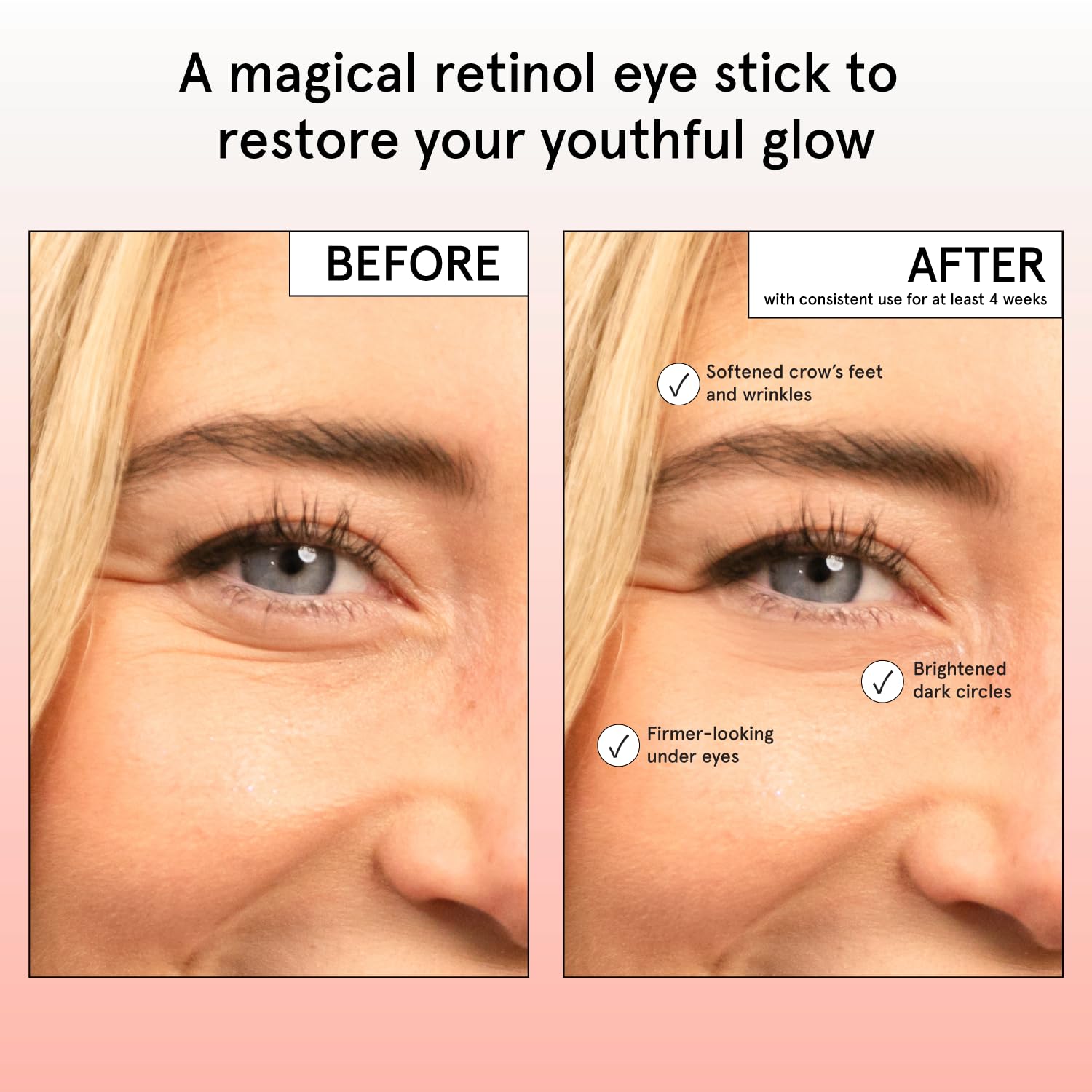 grace & stella Retinol & Caffeine Eye Cream Stick - Under Eye Cream for Dark Circles, Anti-Aging, Puffiness, Wrinkles, Undereye Bags - Brightener with Niacinamide - Vegan Skincare (0.13 oz/3.5 g)