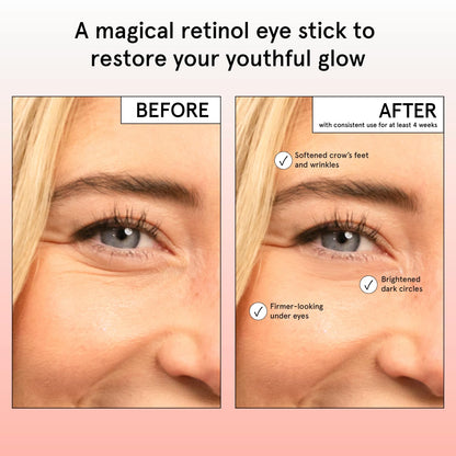 grace & stella Retinol & Caffeine Eye Cream Stick - Under Eye Cream for Dark Circles, Anti-Aging, Puffiness, Wrinkles, Undereye Bags - Brightener with Niacinamide - Vegan Skincare (0.13 oz/3.5 g)