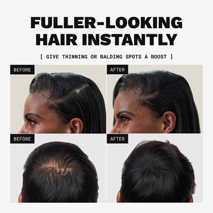 TOPPIK Hair Building Fibers, 27.5 g, Fill In Fine or Thinning Hair, Instantly Thicker Looking, Multiple Shades for Men & Women