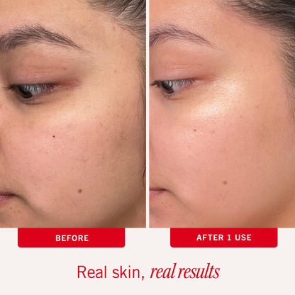 First Aid Beauty - Facial Radiance Pads with Glycolic & Lactic Acids, Daily Exfoliating Pads with AHA, Visibly Smaller Pores, Help Tone & Brighten Skin, One-Step Makeup Prep, Compostable, 28 First Aid Beauty