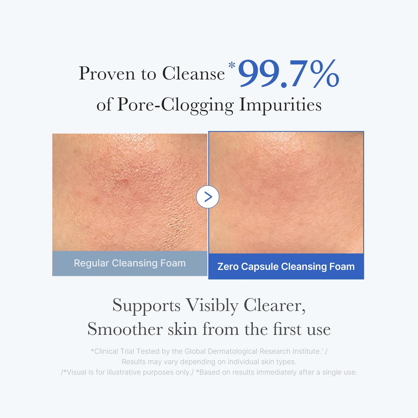 medicube Zero Pore Clear Blue Capsule Facial Deep Cleanser for Skin Texture, Blackhead & Pore Care | AHA, BHA & PHA for Double Cleansing, Daily Gentle Face Wash, Korean Skincare | 120g / 4.23 oz - Available at All In One Marketplace Canada