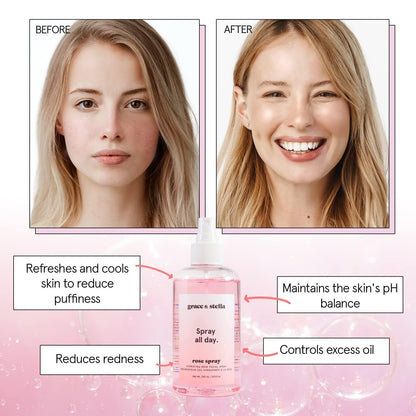 Grace and Stella Award Winning Rose Water Facial Spray (240ml) - Vegan - Rose Water Spray For Face - Rosewater Spray Toner Rose Hydrosol - Rose Spray Facial Mist - Rosewater Spray Toner Rose Hydrosol - Spray all Day - Available at All In One Marketplace Canada
