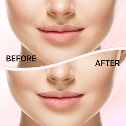 Kradaa Facial Hair Removal for Women: Electric Face Razor with LED Light - Painless & Instant Results Mini Shaver for Travel Use (Rose Gold) - Available at All In One Marketplace Canada