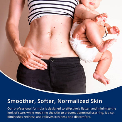 100% Silicone Scar Gel Scar Cream - Advanced Scar Gel for Old and New Scars - Available at All In One Marketplace Canada