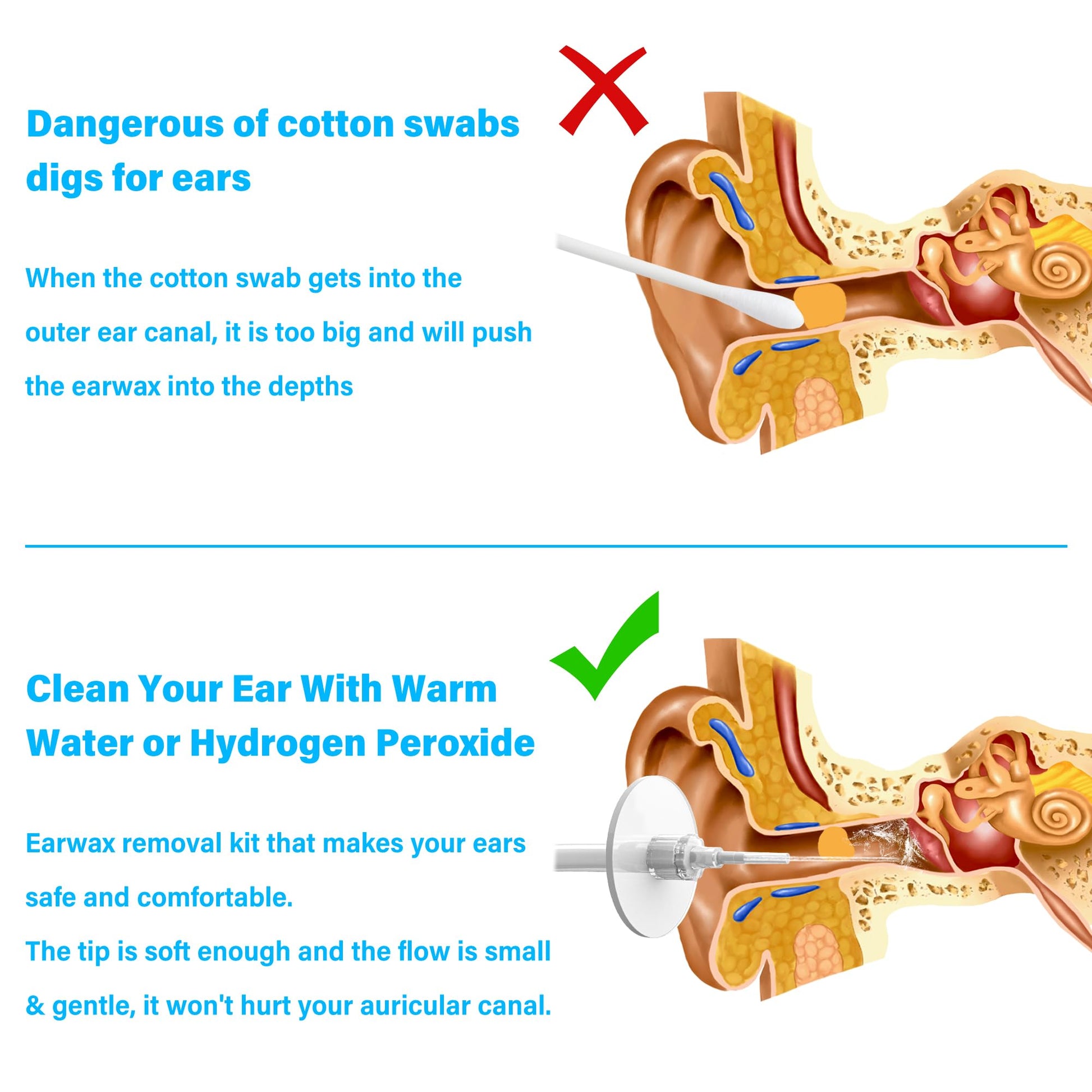 TopQuaFocus 500ml Earwax Remover Ear Cleaner Irrigation Tool Ear wax Removal Flushing System Earwax Cleaning Spray Bottles Ear Flush System for Adults & Kids (16.9oz) - Available at All In One Marketplace Canada