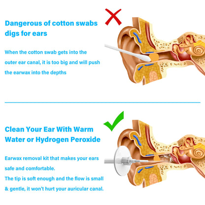 TopQuaFocus 500ml Earwax Remover Ear Cleaner Irrigation Tool Ear wax Removal Flushing System Earwax Cleaning Spray Bottles Ear Flush System for Adults & Kids (16.9oz) - Available at All In One Marketplace Canada