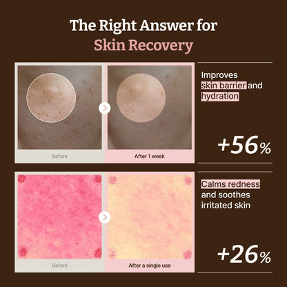 Dr. Reju-All Advanced PDRN Rejuvenating Cream – 99% Pure Salmon DNA Gel Type Face Moisturizer – Optimal 1200ppm for Glass Skin & Plumping – Korean Pharmacy Anti-Aging Skin Care Face Cream - 20ml