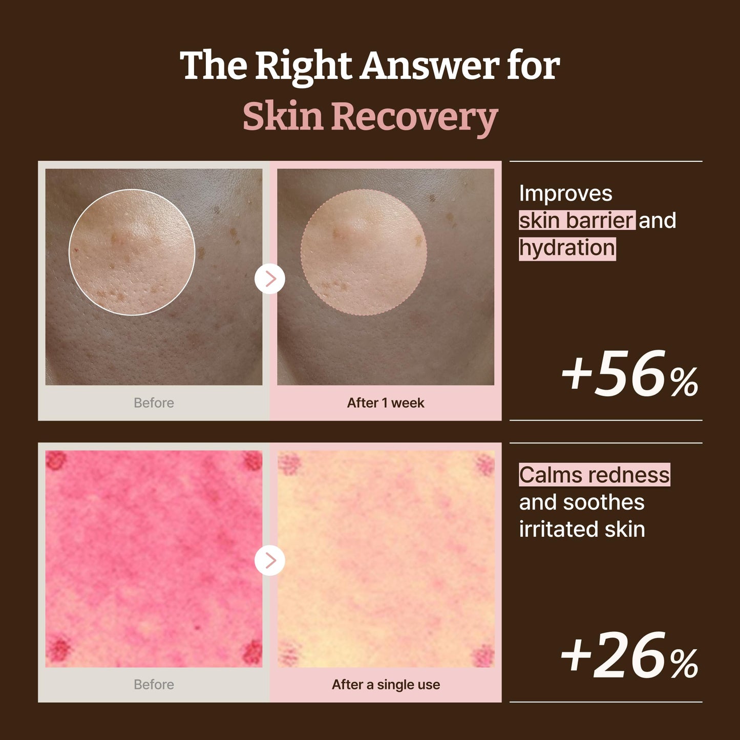 Dr. Reju-All Advanced PDRN Rejuvenating Cream Max – 99% Pure Salmon DNA Gel Type Face Moisturizer – Optimal 1200ppm for Glass Skin & Plumping – Korean Pharmacy Anti-Aging Skin Care Face Cream - 60ml