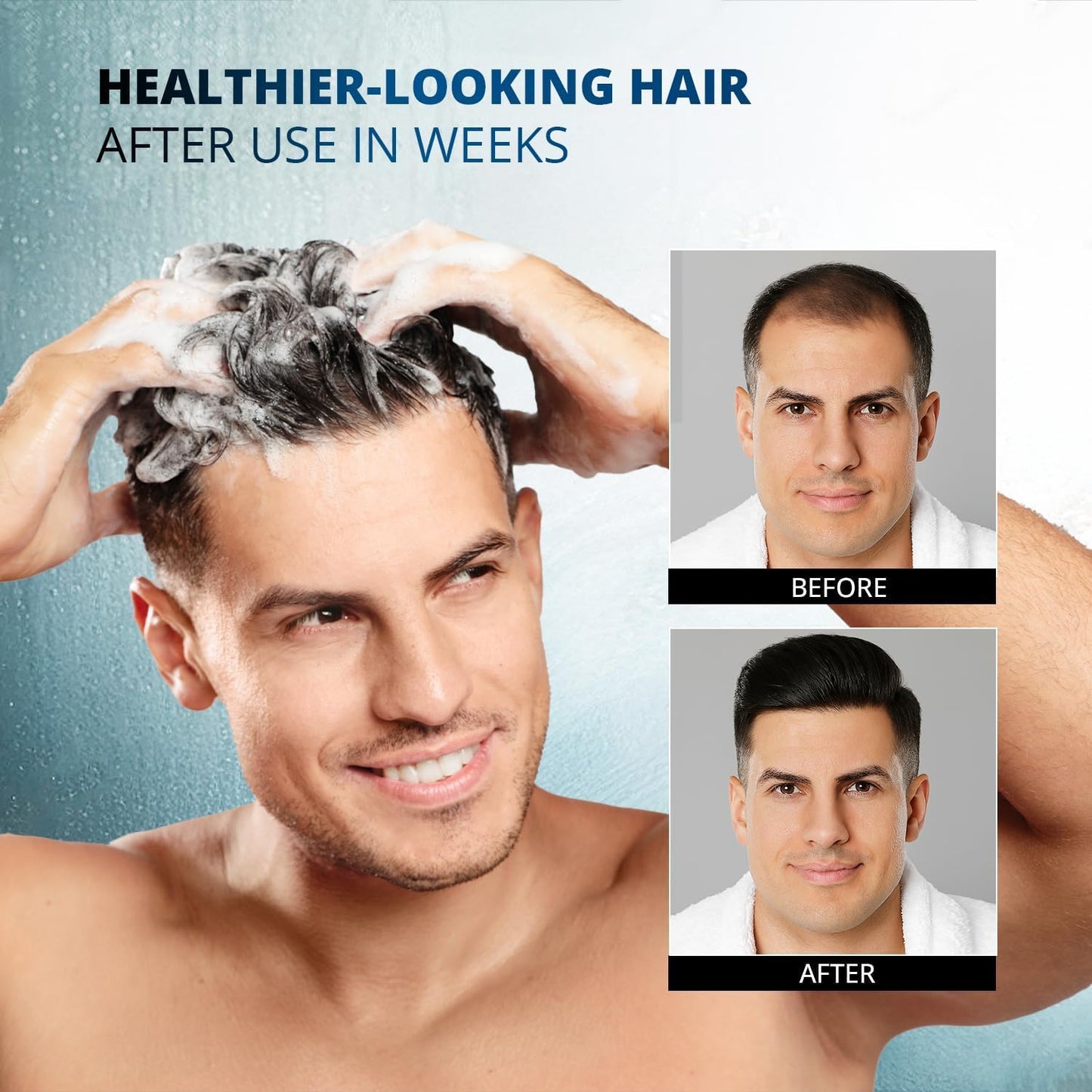 Root Activator Shampoo: 300ML Natural Volume Hair Loss Thickening Shampoo With Rosemary Strengthens Hair & Soothes Scalp For Men - Available at All In One Marketplace Canada
