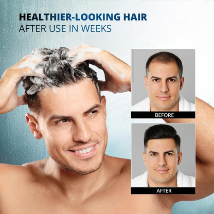 Root Activator Shampoo: 300ML Natural Volume Hair Loss Thickening Shampoo With Rosemary Strengthens Hair & Soothes Scalp For Men - Available at All In One Marketplace Canada