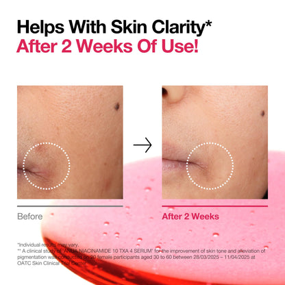 Miracle Korean Serum NIACINAMIDE 10% + TXA 4% DARK SPOT REMOVING SERUM 30mL - 14 days miracle A_N_U_A import
