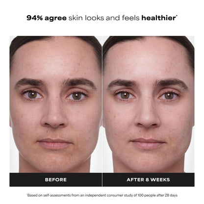 Paula's Choice CLINICAL 1% Retinol Treatment Cream with Peptides, Vitamin C & Licorice Extract, Anti-Aging Treatment for Wrinkles & Loss of Firmness, Fragrance-Free, 30 mL - Available at All In One Marketplace Canada