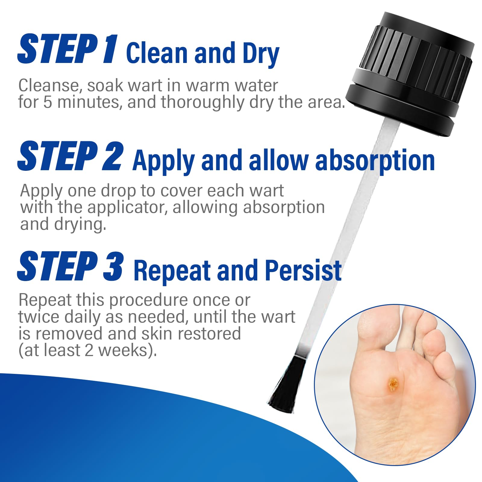 OSNOIA Extra Strength Wart Remover Liquid with 17% Salicylic Acid, Fast Acting Treatment for Plantar & Common Warts, Corn Remover for Feet and Toes (15ml, Wart Remover Set) - Available at All In One Marketplace Canada