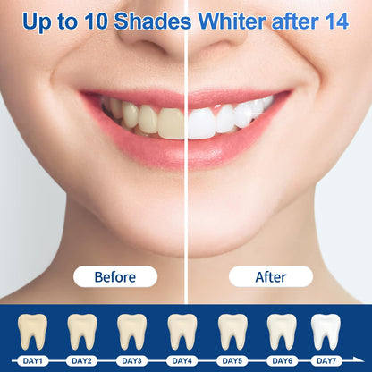 35% Ganencsnc 10-Pack Teeth Whitening Gel Refills - Gentle 35% Carbamide Peroxide Formula - Compatible with Teeth whitening Kit,No Sensitive Teeth Whitener - Available at All In One Marketplace Canada