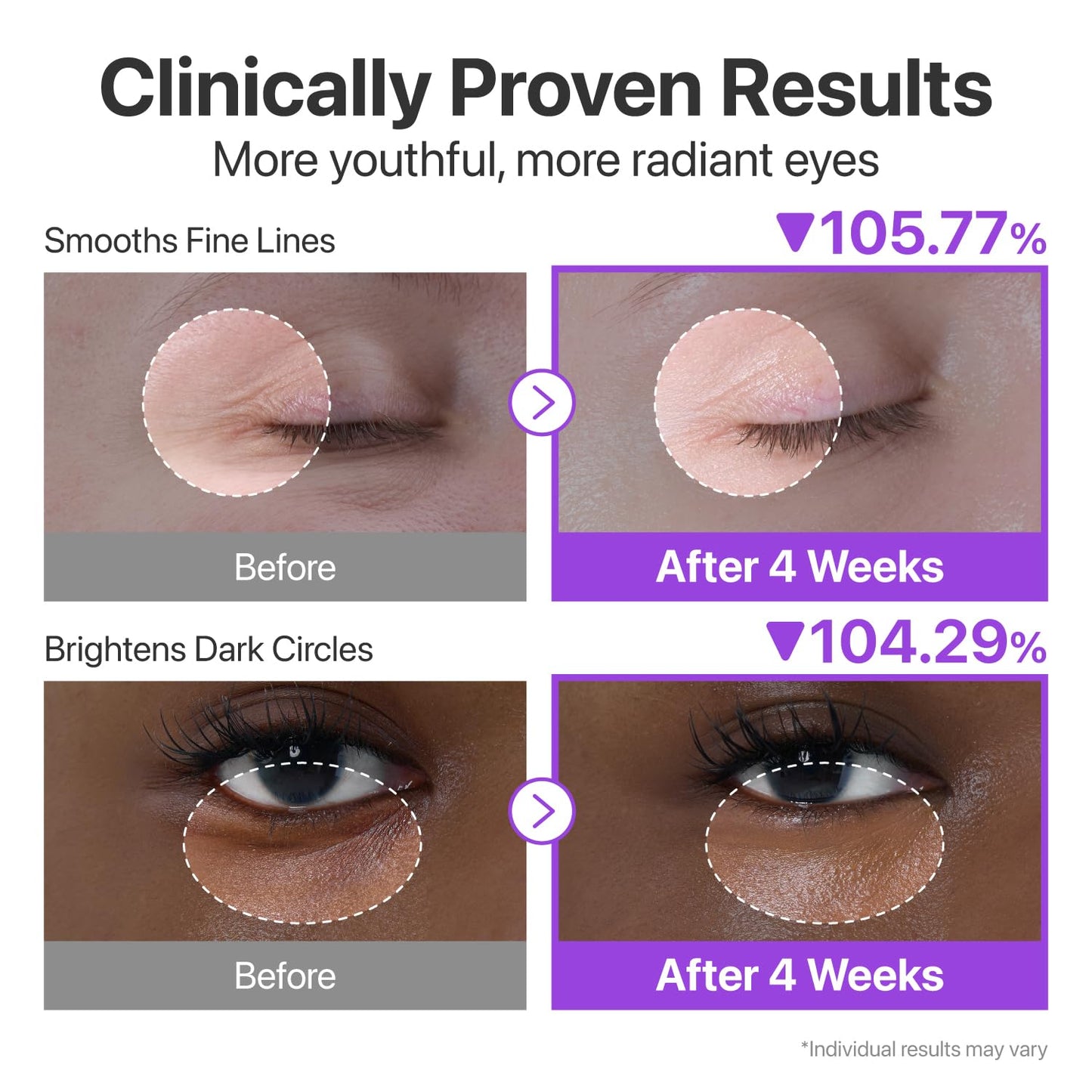 numbuzin No.9 NAD+ Retinol Eye Cream, Depuffing & Firming Eye Serum for Dark Circles, Wrinkles & Fine Lines, Peptides & Niacinamide for Glow & Undereye Radiance, Stocking Stuffers 0.33 fl oz - Available at All In One Marketplace Canada