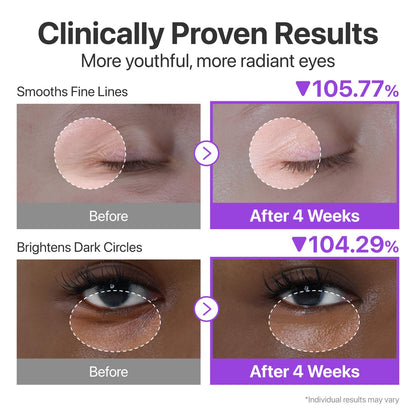 numbuzin No.9 NAD+ Retinol Eye Cream, Depuffing & Firming Eye Serum for Dark Circles, Wrinkles & Fine Lines, Peptides & Niacinamide for Glow & Undereye Radiance, Stocking Stuffers 0.33 fl oz - Available at All In One Marketplace Canada