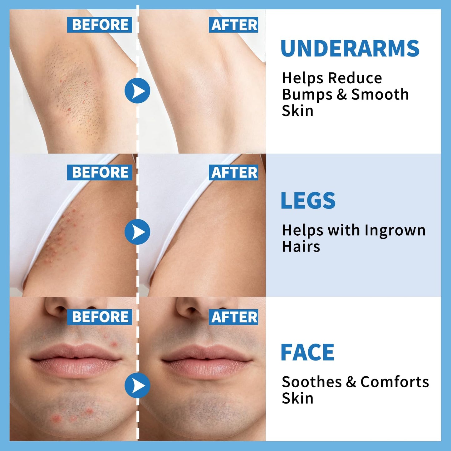dewyhour Ingrown Hair & After Shave Soothing Serum – Soothes Razor Irritation, Targets Dark Spots, Helps With Razor Bumps for Face, Underarms, Neck & Bikini Area. Korean Skincare Roll-On for Men & Women