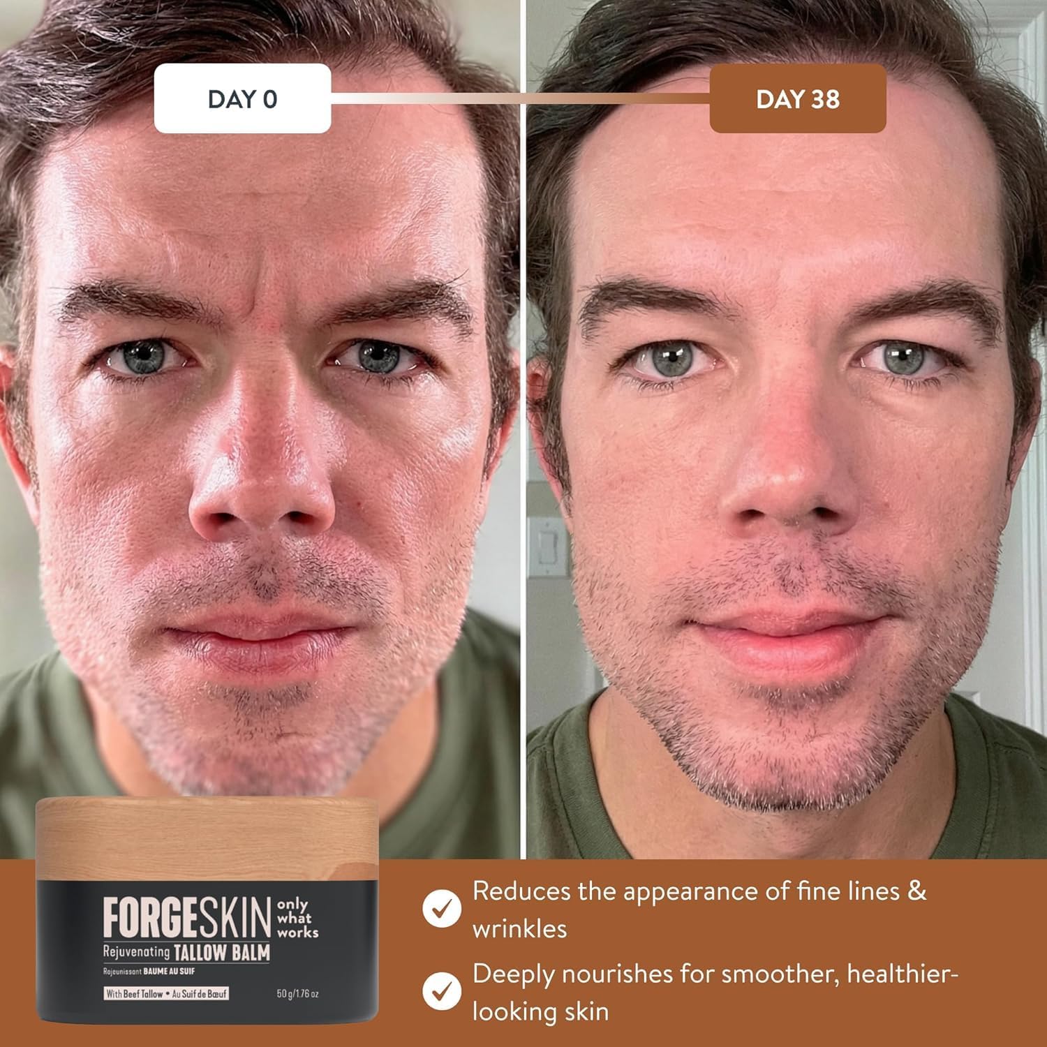 FORGE SKIN® Wrinkle Defense Beef Tallow Balm for Men [TALLOW-BASED] Moisturizer for Face Hydration - Hydrating Anti Aging Skin Cream - Natural Facial Skincare Lotion with Essential Oils (1.7 OZ) - Available at All In One Marketplace Canada