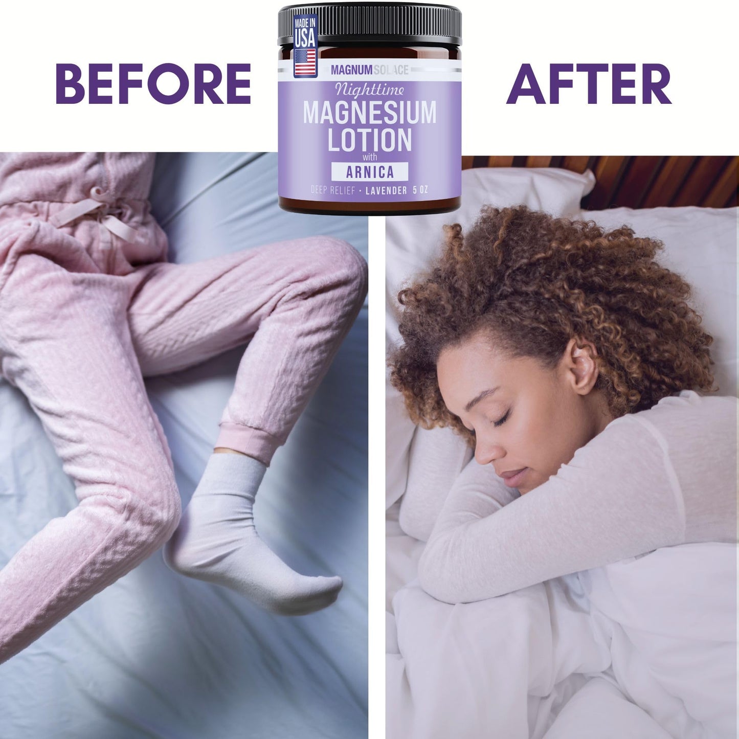 Nighttime Magnesium Lotion with Arnica – Highly Concentrated Magnesium for Muscles & Joints – Apply to Legs or Feet Before Bed – Skin-Friendly - Available at All In One Marketplace Canada