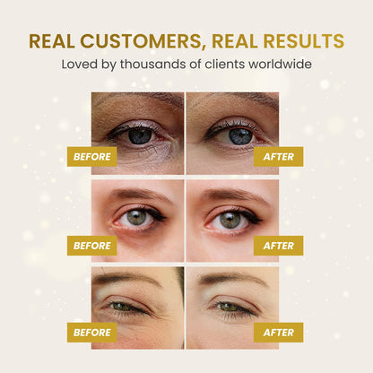 PLANTIFIQUE 24K Gold Under Eye Patches - Dermatologist Tested - 20 Pairs Cooling Eye Masks for Dark Circles & Puffiness, with Collagen & Hyaluronic Acid - Patch Yeux - Available at All In One Marketplace Canada