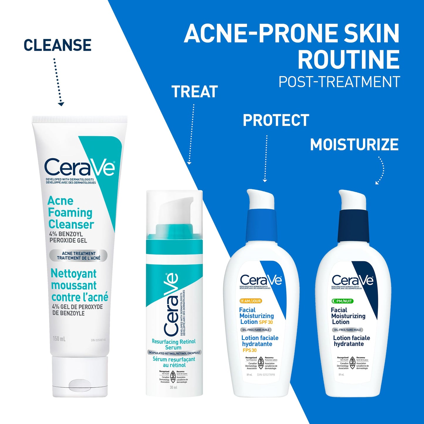 CeraVe 4% Benzoyl Peroxide Acne Treatment Foaming Cleanser Face & Body Wash, with Hyaluronic Acid and Niacinamide. Helps Clear Acne Pimples and prevent breakouts. Gentle Gel, Fragrance-Free, 150ML