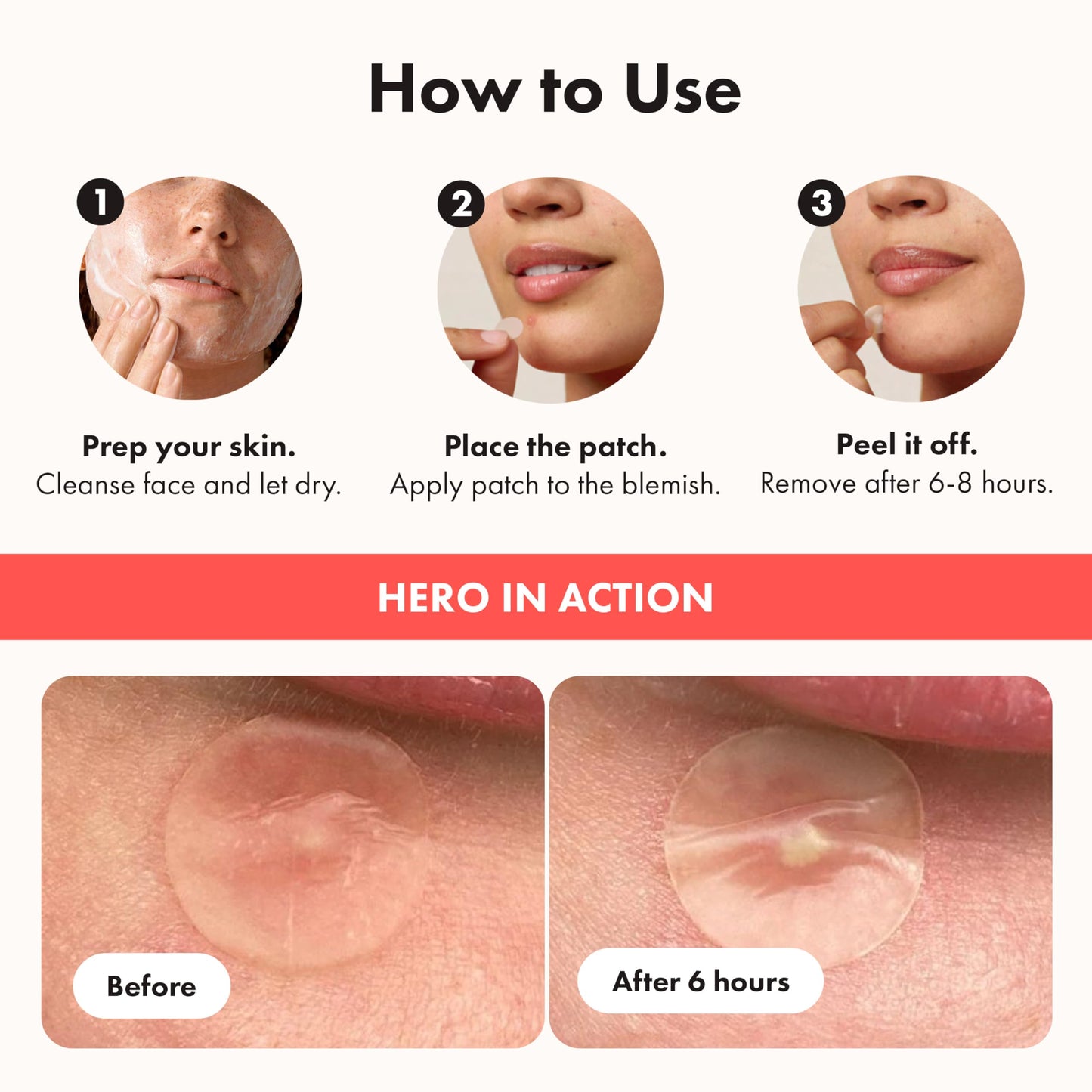 Hero Cosmetics Mighty Patch Original – Hydrocolloid Patch for Pimples, Overnight Acne Blemish & Zit Stickers for Sensitive Skin, (72 Count)