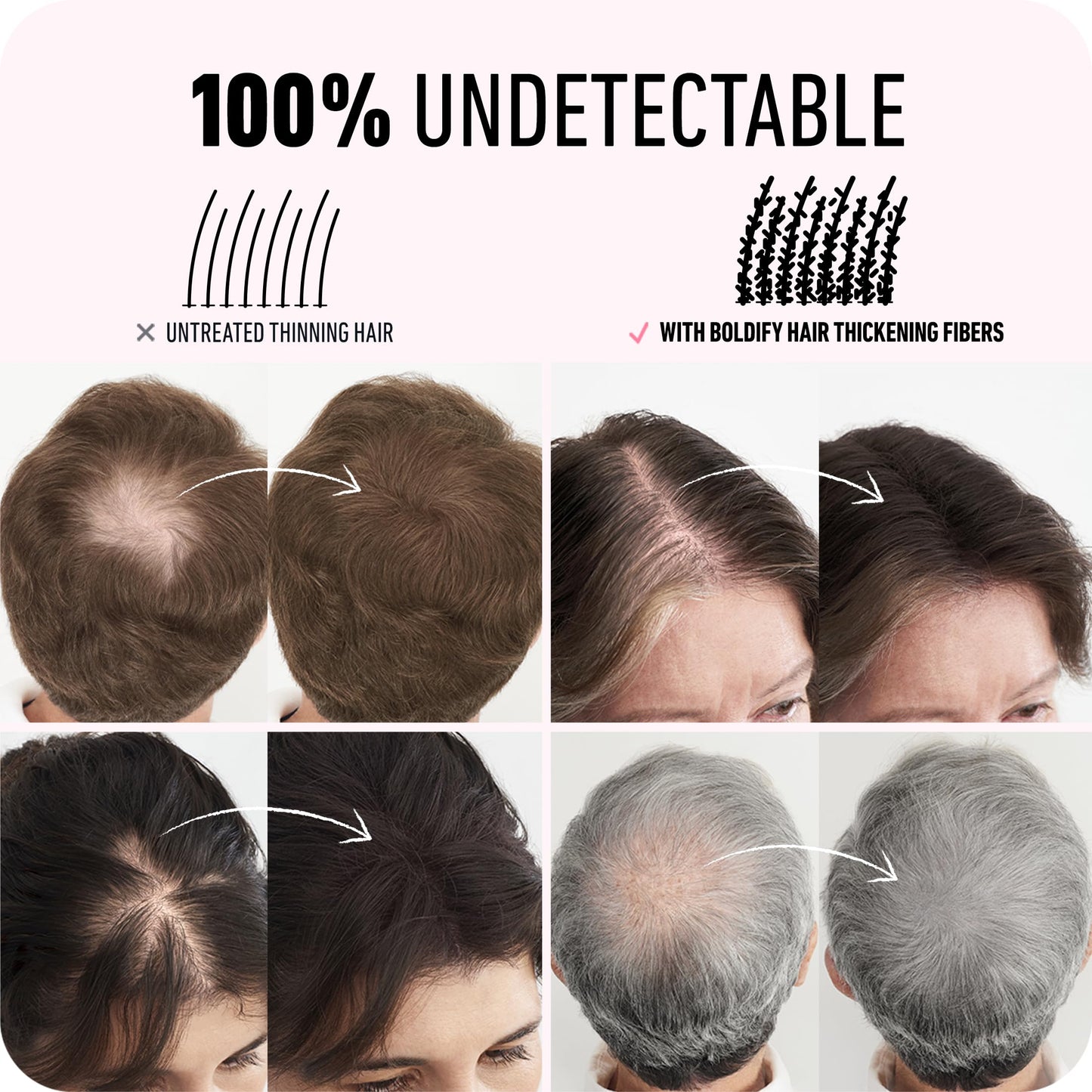 BOLDIFY Hair Fibers (28g) - Fill In Thinning and Fine Hair for an Instantly Fuller, Thicker Look - 14 Shades for Women & Men - Black - Available at All In One Marketplace Canada
