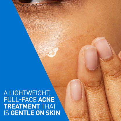 CeraVe Acne Control Gel For Face, Pimple & Pores, With Salicylic Acid, 3 Essential Ceramides, Niacinamides. Developed with Dermatologists, Non-Comedogenic, Oil-Free, Fragrance-Free, 40ml - Available at All In One Marketplace Canada