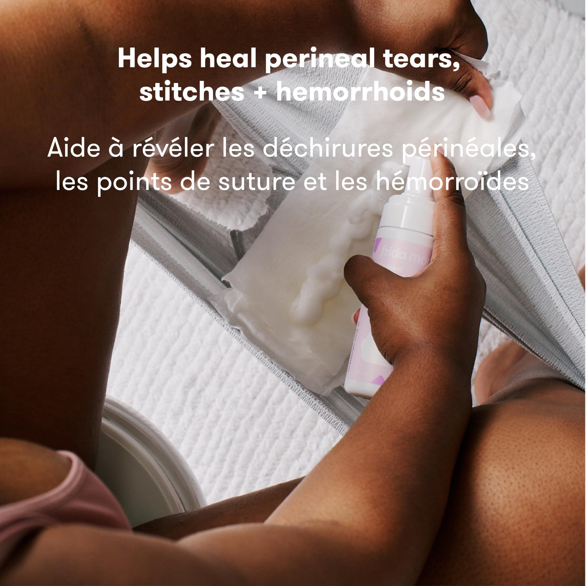 Frida Mom Witch Hazel Perineal Healing Foam for Postpartum Care, Cooling Pain Relief and Hemorrhoid Treatment, 5 Fl Oz