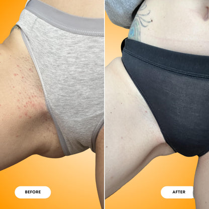 Bushbalm Ingrown Hair Exfoliating Scrub – Pre-Shave Sugar Scrub for Ingrown Hairs, Razor Bumps & Dry Skin – Gently Buffs & Soothes Sensitive Skin - Vanilla Tangerine 236 ml - Formerly Sweet Escape - Available at All In One Marketplace Canada