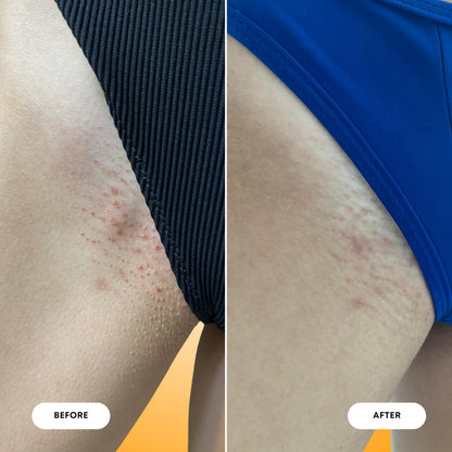 Bushbalm Ingrown Hair and Razor Bumps 2-Step Routine - Moisturize and Calm - Ingrown Hair Oil (30 ml) and Exfoliating Scrub (236 ml) - Vanilla Tangerine - Available at All In One Marketplace Canada