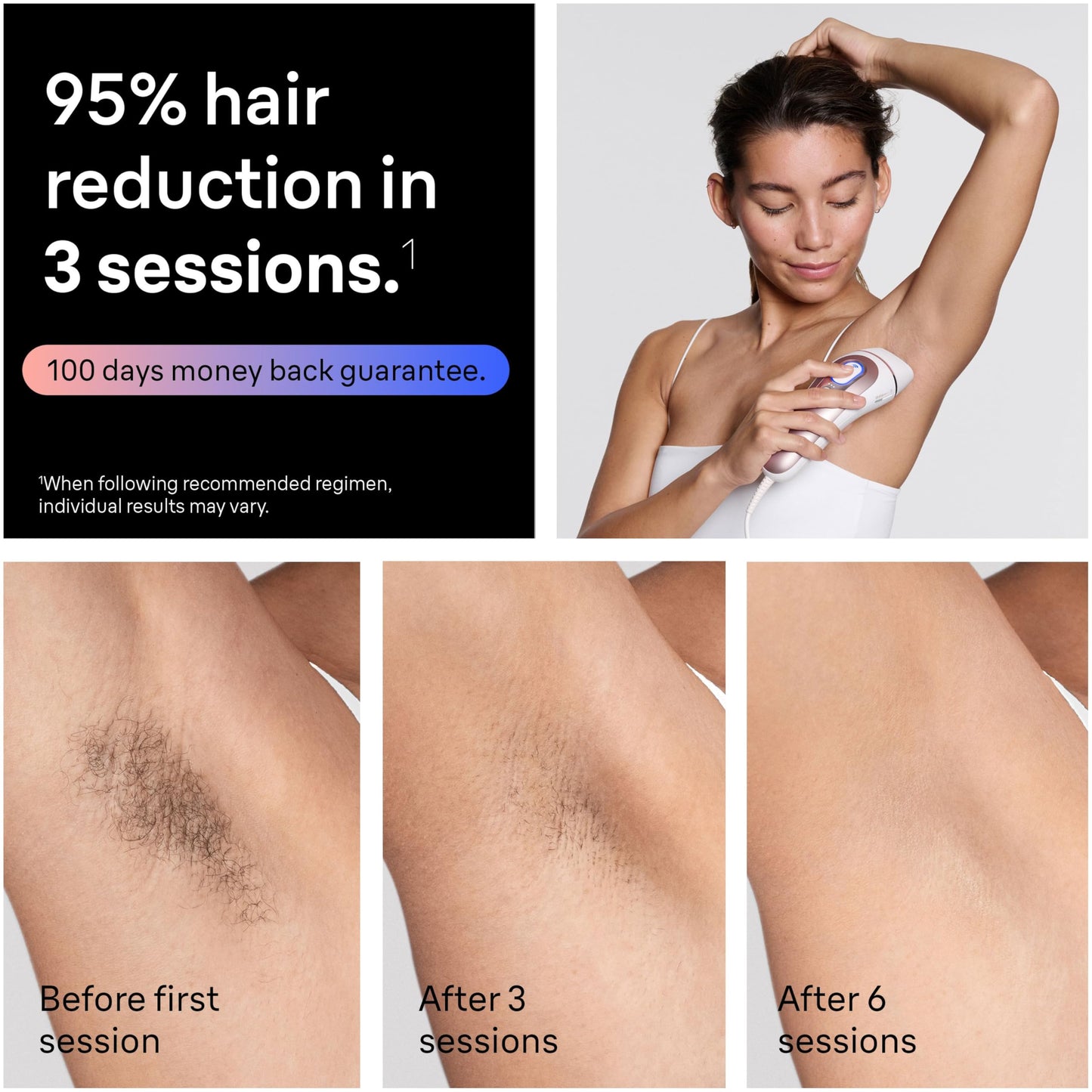 Braun IPL, Laser Hair Removal for Women & Men, Skin i-Expert IPL 7, Smart At-Home Laser with Venus Razor + 3 Heads + App, PL7243 - Available at All In One Marketplace Canada